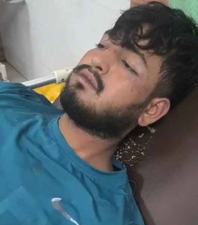 जमशेदपुर :  सिदगोड़ा में युवक पर चापड़ से हमला, TMH में भर्ती, पुलिस जांच में जुटी
