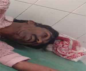 मेदिनीनगर जोड़ हाईवे पर अज्ञात वाहन के धक्के से बाइक सवार घायल