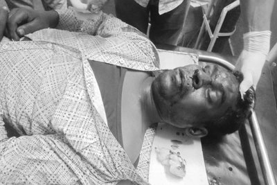 लातेहारः सड़क दुर्घटना में चतरा का युवक गंभीर रूप से घायल, रिम्स रेफर