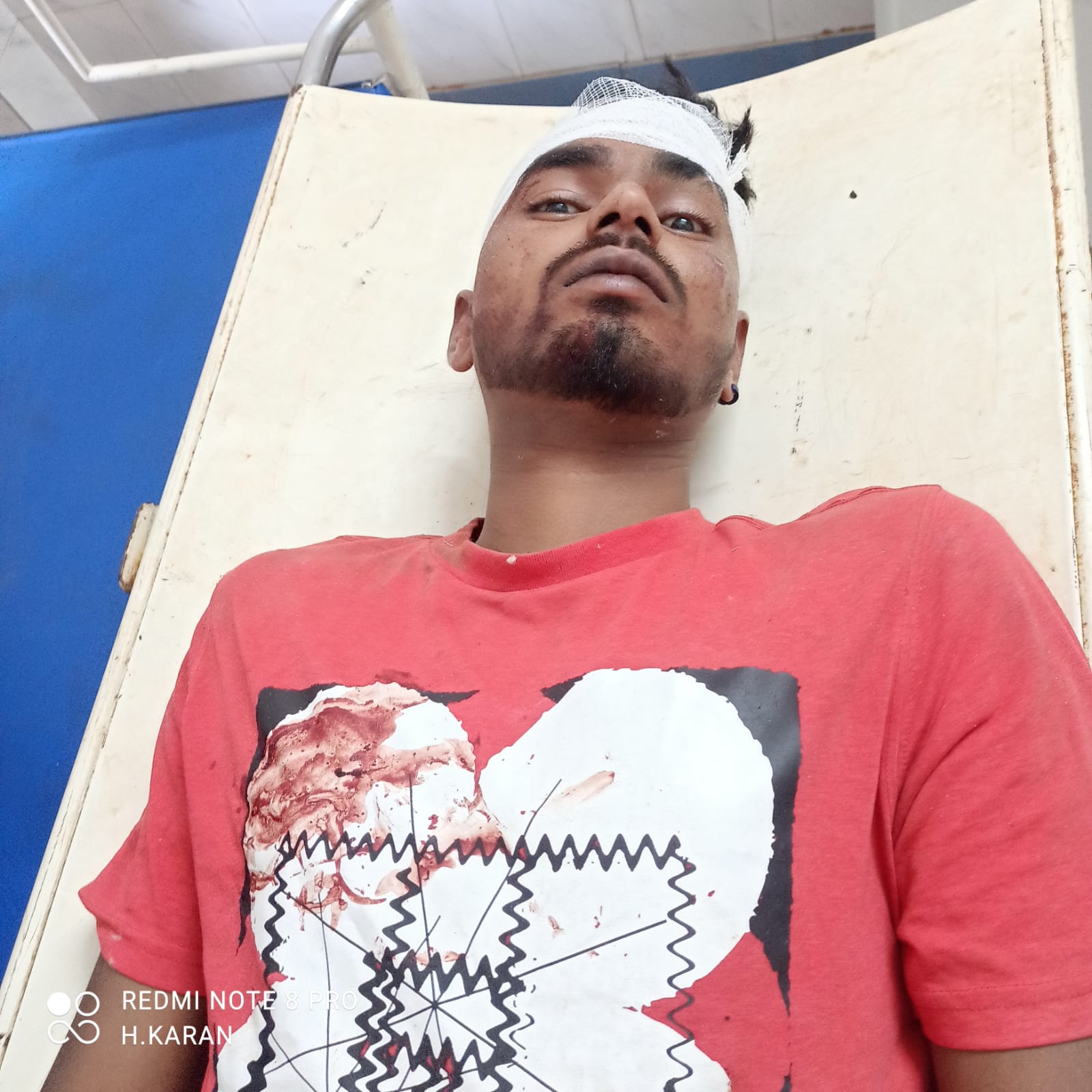 बहरागोड़ा: डिवाइडर से टकराई बाइक, धनाडाही का युवक गंभीर रूप से घायल