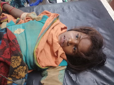 लातेहारः महुआ चुनने गई बच्ची को सांप ने काटा, हालत गंभीर