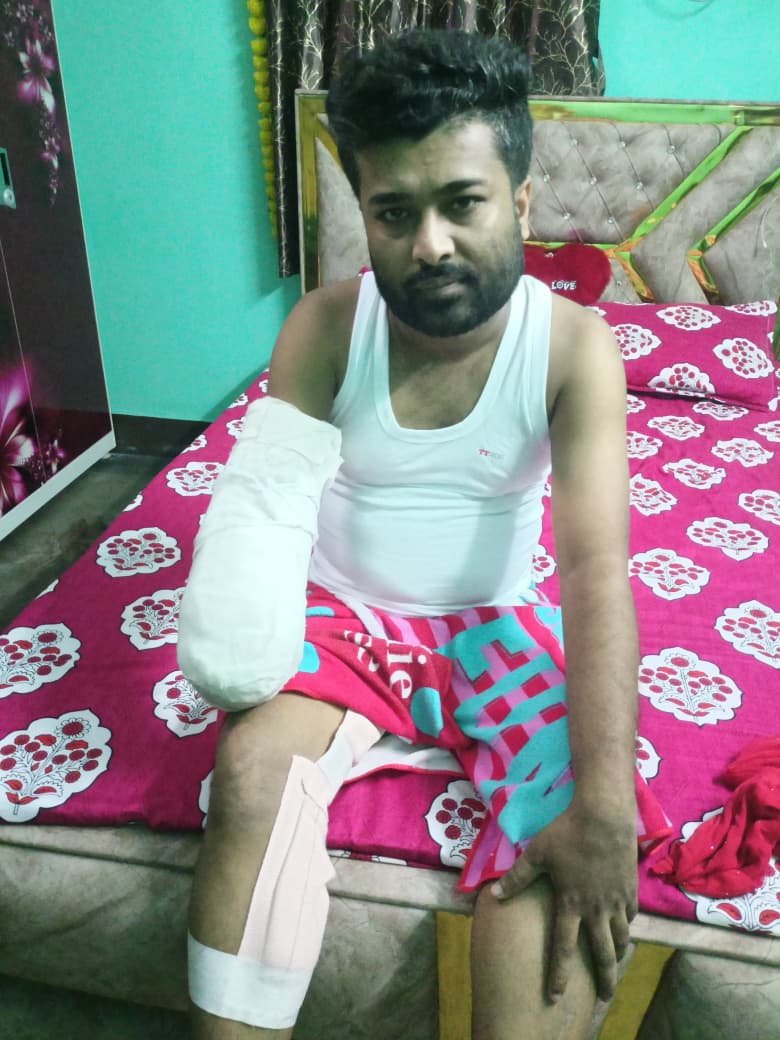 Jamshedpur News : टाटा स्टील कलर्स में हादसा, मशीन की चपेट में आकर कर्मचारी का हाथ कटा