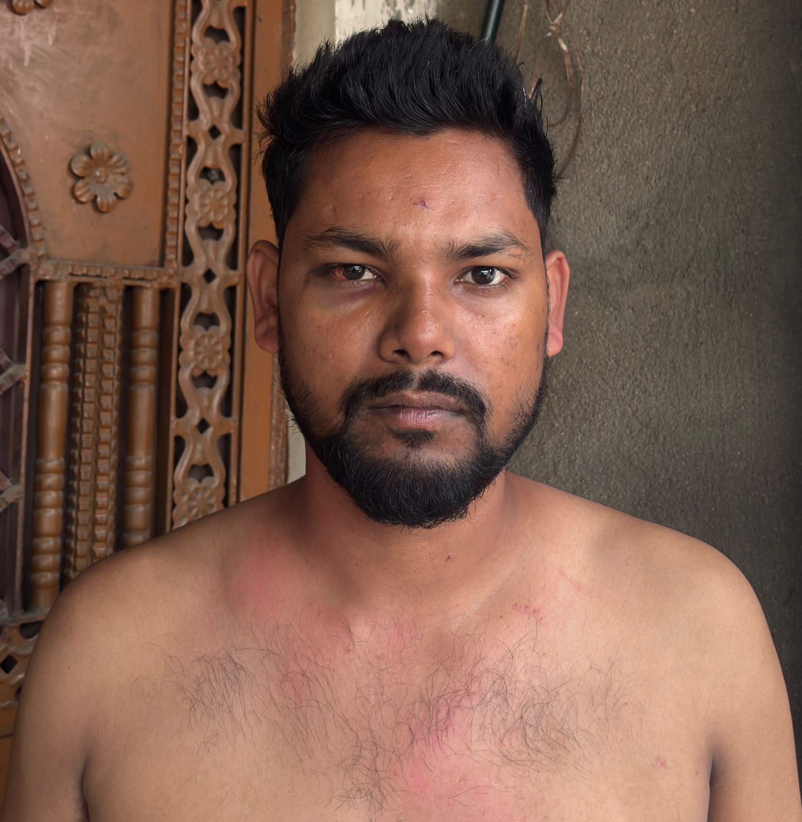 Youth injured