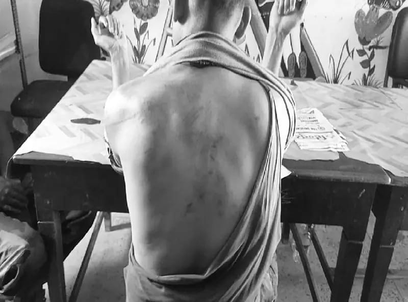 Jamtara News : कोयला चोरी रोकने गए होमगार्ड जवान को बंधक बनाकर पीटा, जांच में जुटी पुलिस