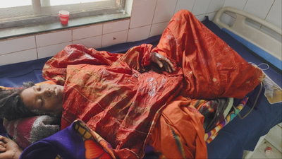 Palamu News : पति ने पत्नी को पेट्रोल छिड़ककर जलाया, हालत गंभीर