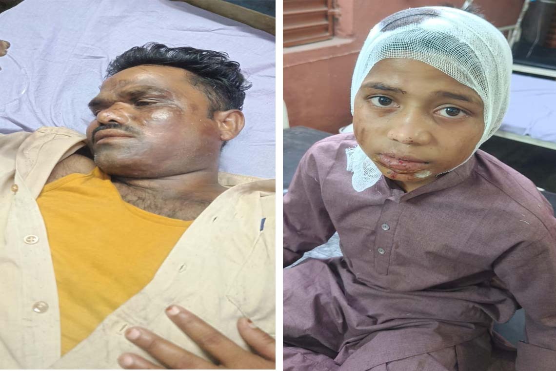 Latehar News : सड़क दुर्घटना में बाइक सवार पिता-पुत्र घायल, पिता रिम्स रेफर