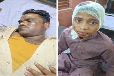 Latehar News : सड़क दुर्घटना में बाइक सवार पिता-पुत्र घायल, पिता रिम्स रेफर