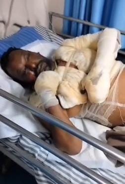 झरिया में 3 लोगों को पेट्रोल डालकर जिंदा जलाने की कोशिश, एक की हालत गंभीर; जेएमएम नेता पर आरोप