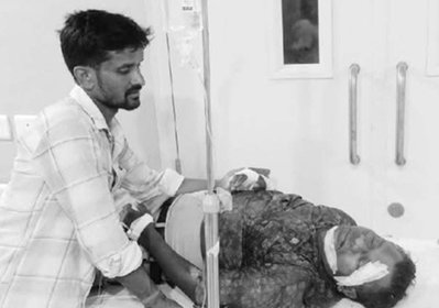 Jamshedpur News : डिमना लेक के पास दो बाइक की टक्कर में बच्चा समेत 3 लोग घायल
