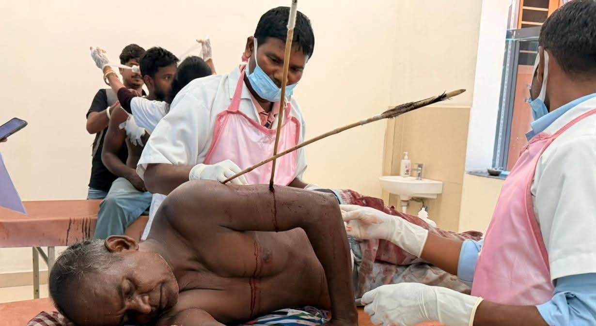 Chaibasa News : झींकपानी में जमीन विवाद में तीर से हमला, एक घायल