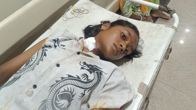 Jamshedpur News: मोबाइल को लेकर भाई-बहन में विवाद, लड़की ने ब्लेड से खुद को किया घायल
