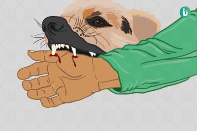 झारखंड में रेबीज नियंत्रण पर जोर, सरकारी अस्पतालों में वैक्सीन रखना जरूरी