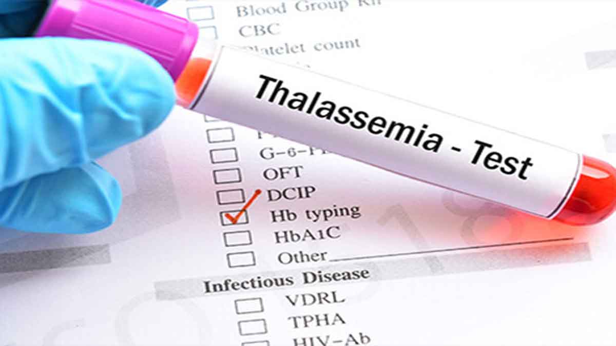 Thalassemia  photo
