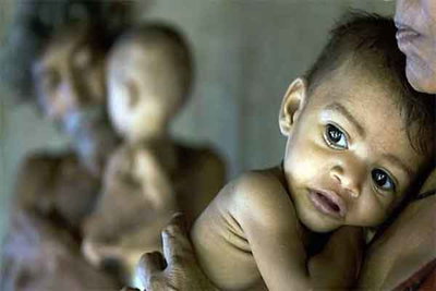 झारखंड में 68 फीसदी छोटे बच्चे एनीमिया के शिकार, IFA खुराक में तेजी के निर्देश