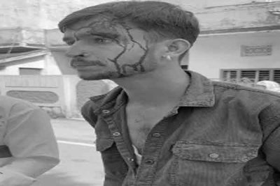 रांची: सुखदेव नगर में ब्राउन शुगर के पैसे को लेकर दो गुट भिड़े, दो युवक घायल