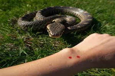 Jharkhand News: Snake Bite के मामलों में लगातार इजाफा, 4 साल में 9 हजार से ज्यादा केस
