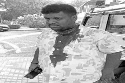 Jamshedpur News: ईंट-बालू कारोबारी पर चाकू से हमला, बुलेट सवार दो युवकों ने दी धमकी