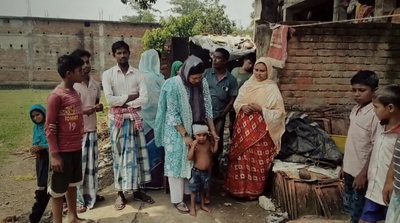 Pakur News: पाकुड़ में सियार का आतंक जारी, फिर बच्चे पर हमला, ग्रामीणों में दहशत