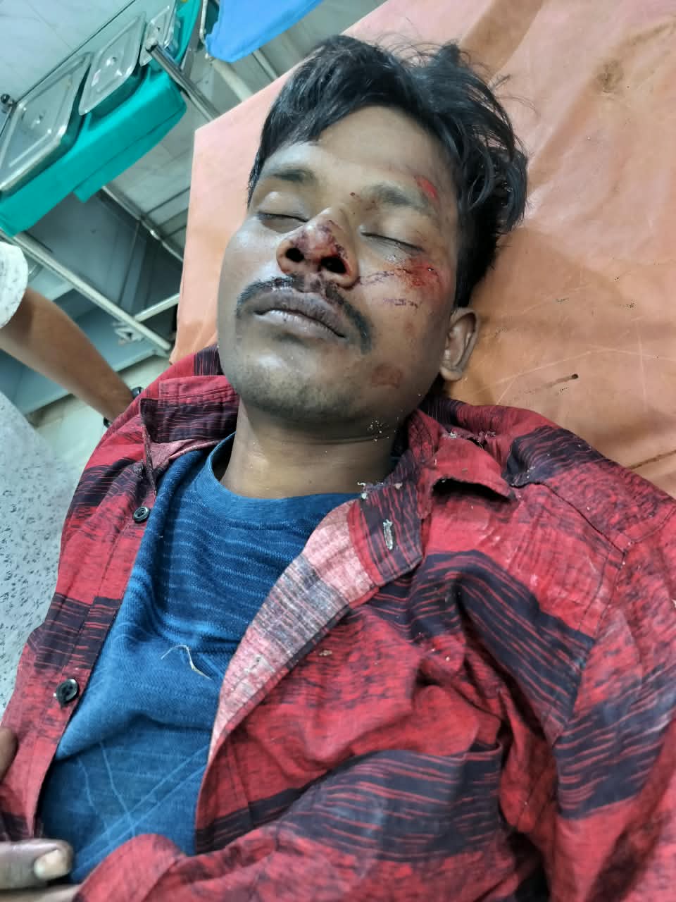 बहरागोड़ा में NH-49 पर बाइक सवार दुर्घटना में हुआ घायल, बेहतर इलाज के लिए रेफर