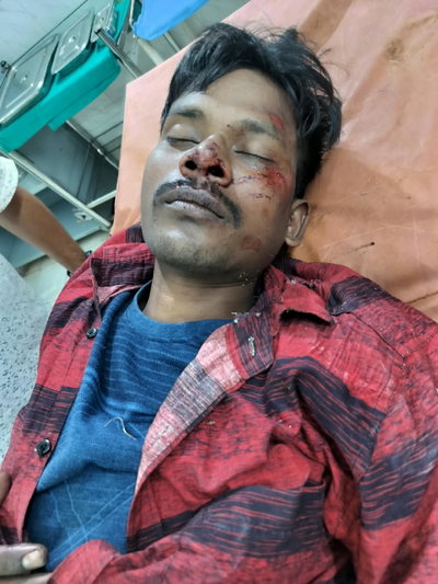 बहरागोड़ा में NH-49 पर बाइक सवार दुर्घटना में हुआ घायल, बेहतर इलाज के लिए रेफर