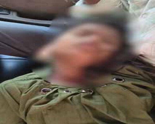 लातेहार: ईंट को भिगाने वाले गड्ढे में डूबकर किशोरी की मौत