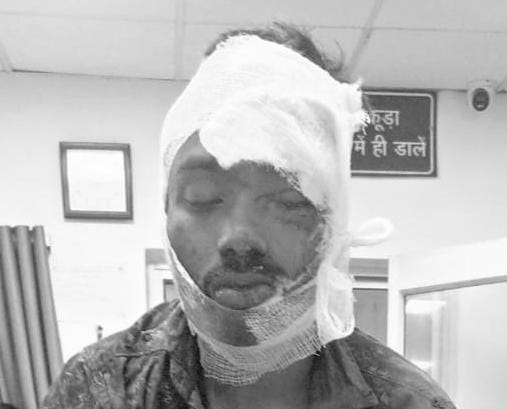 Road accident