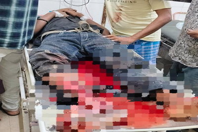 धनबाद: वासेपुर के गुलजारबाग में ओवरब्रिज निर्माण के दौरान हादसा, मजदूर घायल