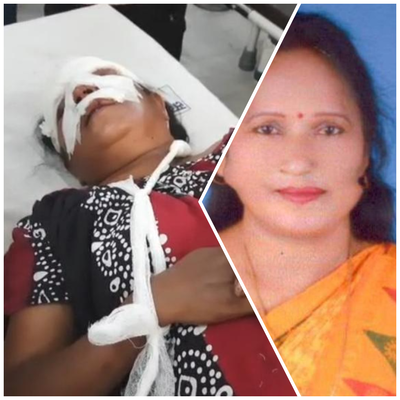 Road Accident Chaibasa: सड़क दुघर्टना में भाजपा जिलाध्यक्ष गीता बालमुचू घायल, इलाज जारी