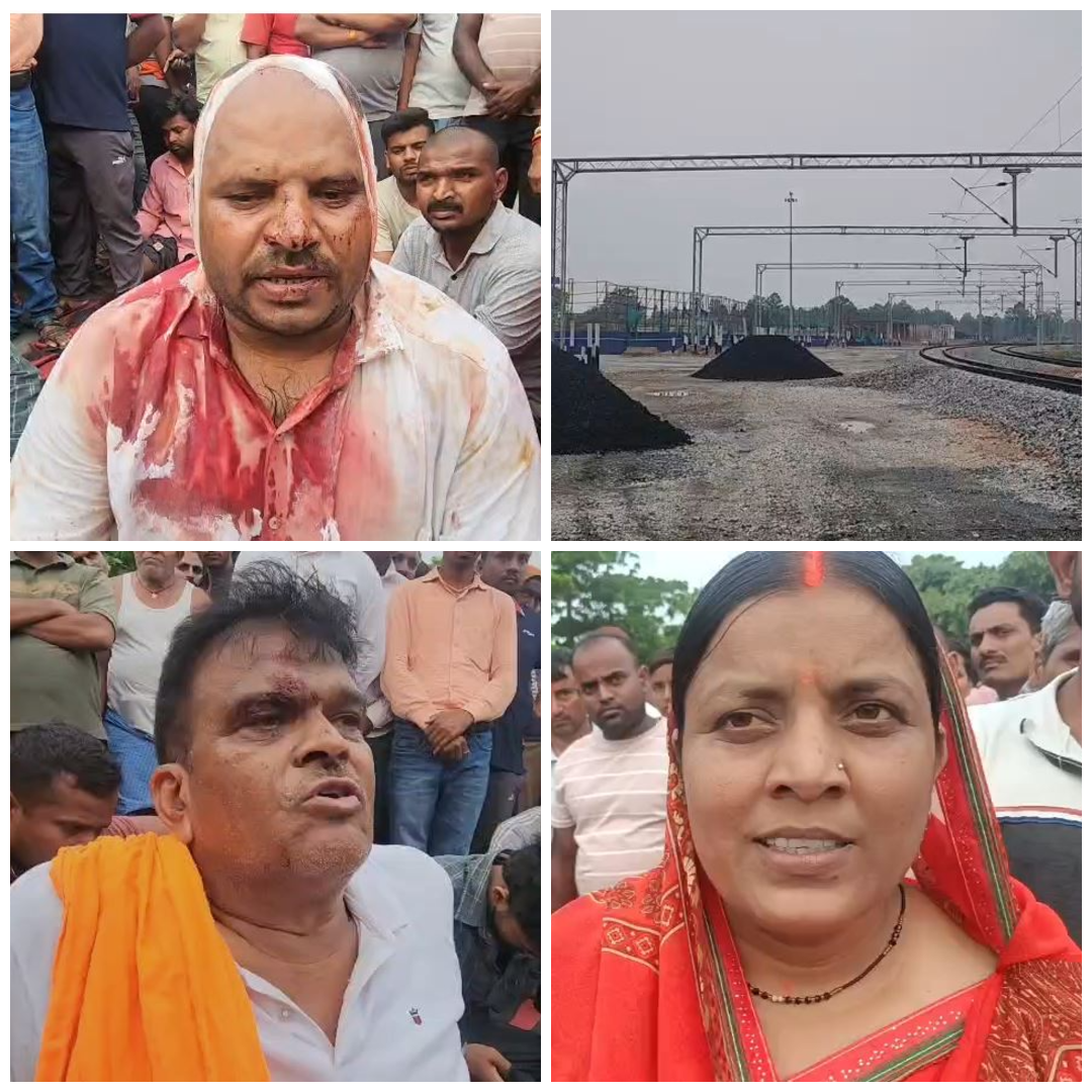 Chatra News: वर्चस्व की लड़ाई में दो गुटों के बीच हिंसक झड़प, आधा दर्जन से अधिक घायल