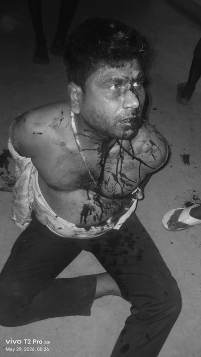 Palamu News: ड्यूटी से लौट रहे डॉक्टर पर हमला, डॉक्टर संगठनों ने दी आंदोलन की चेतावनी