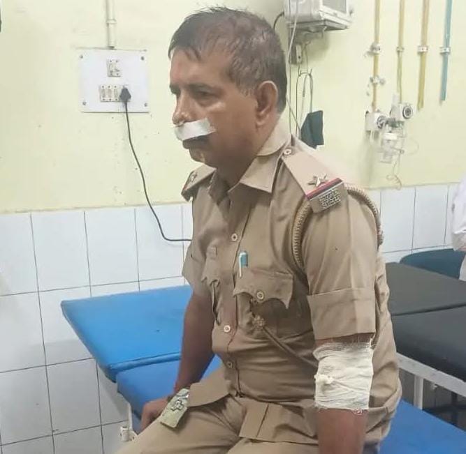 Dhanbad News: धनबाद में चोरों को पकड़ने गई पुलिस टीम पर हमला, SI हरिप्रकाश मिश्रा घायल
