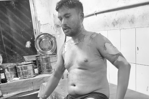 Palamu News: पत्नी से विवाद के बाद युवक ने खुद को लगाई आग, फिर पहुंचा अस्पताल