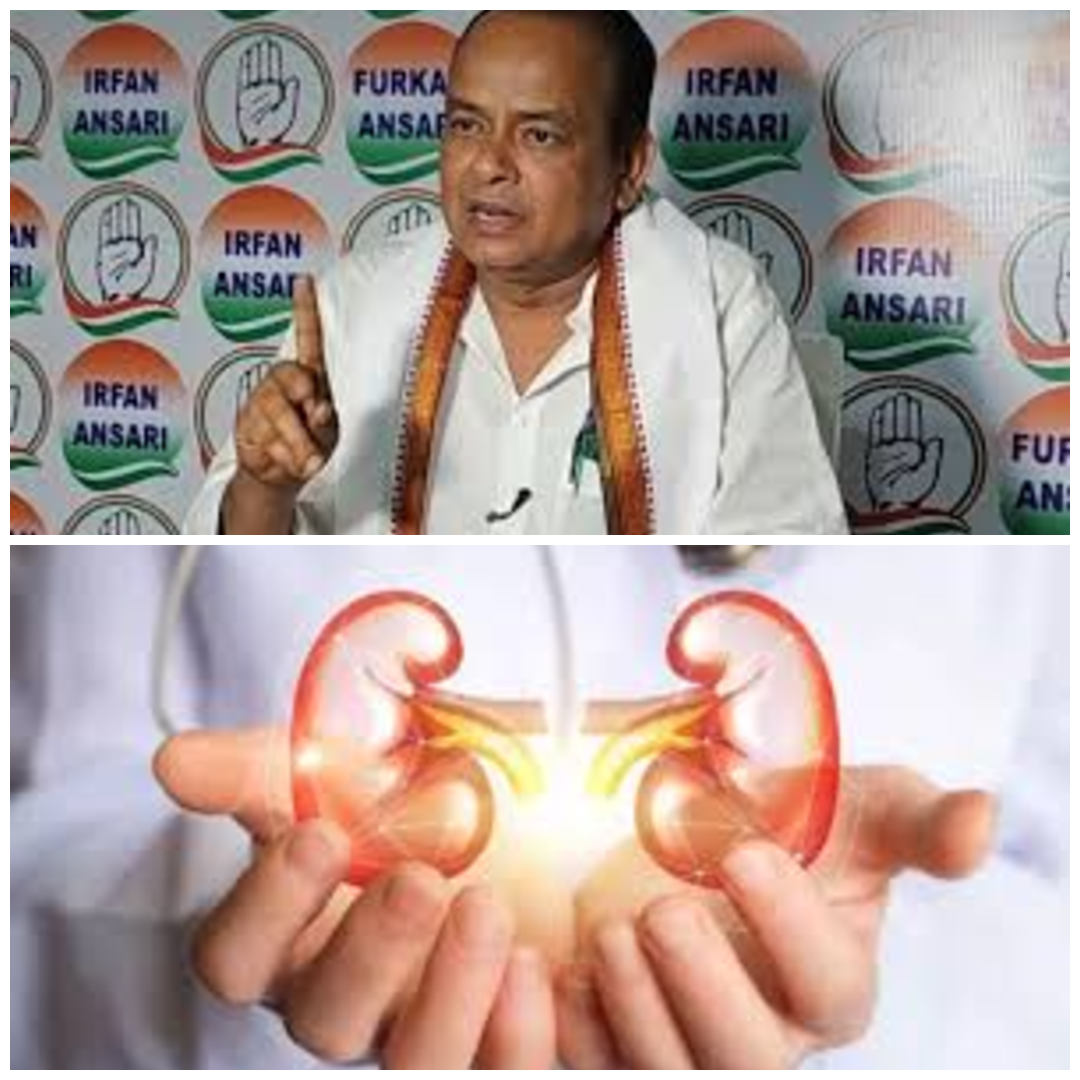 मंत्री इरफान अंसारी का बड़ा ऐलान, किडनी-लिवर ट्रांसप्लांट मरीजों को मिलेगा विशेष आर्थिक पैकेज