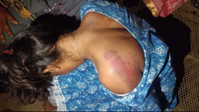 Saraikela News :  कपाली ओपी पुलिस पर आदिवासी युवती को पीटने का आरोप