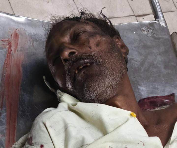 Palamu News :  चियांकी स्टेशन के पास जख्मी हालत में मिला व्यक्ति, ट्रेन से गिरने की आशंका