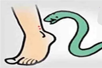Jharkhand News :  सर्पदंश को लेकर स्वास्थ्य विभाग अलर्ट, सभी अस्पतालों को दिए सख्त निर्देश