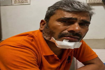 Chakradharpur :  सड़क हादसे के बाद बेहाश रेलकर्मी से स्कूटी व 25 हजार कैश लूटकर बदमाश फरार