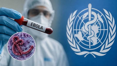Ebola Virus : झारखंड में बस स्टैंड से एयरपोर्ट तक मेडिकल कैंप लगाने की तैयारी