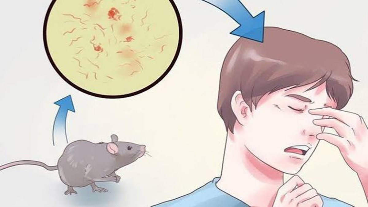 RAT FEVER