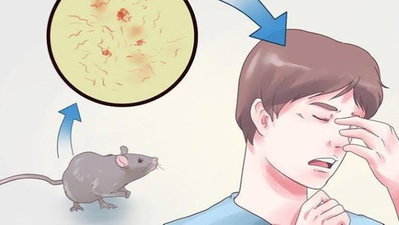 Health News :  रांची में रैट फीवर की एंट्री, 2 माह में 130 से अधिक लोग संक्रमित