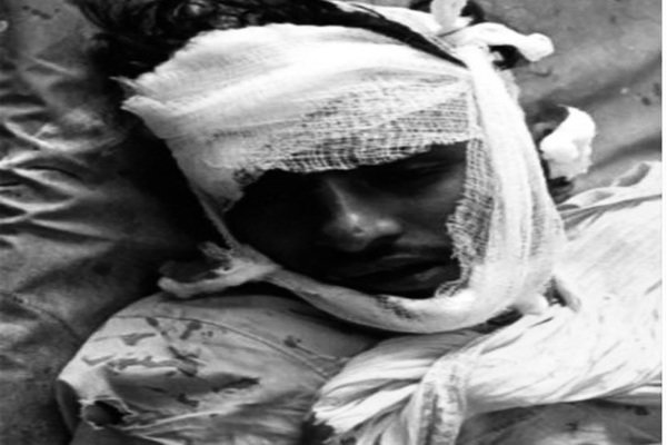 Palamu News : शाहपुर पुल पर स्कूटी-बाइक की टक्कर, दो युवक घायल