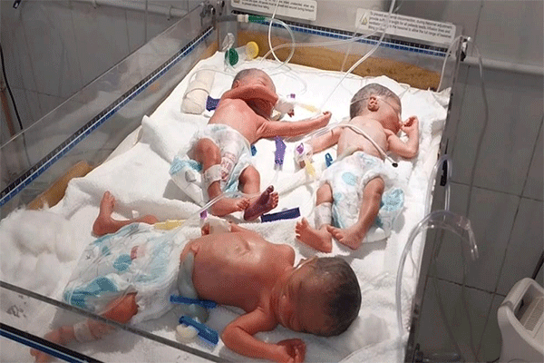 जामताड़ा: नॉर्मल डिलीवरी से एक साथ  तीन बच्चों का जन्म, मां की हालत स्थिर