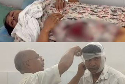 लातेहार : दंपती से दिनदहाड़े लूट, फायरिंग में महिला को दो गोलियां लगी