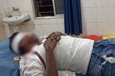 Bahragora : दो बाइकों की भिड़ंत में दंपती समेत 3 घायल, एक की हालत नाजुक