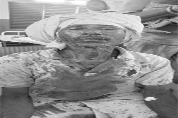 लातेहार : महुआ चुनने के दौरान हुए विवाद में दंपति घायल, सदर अस्पताल रेफर