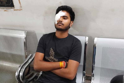 रांची : कोतवाली इलाके में पार्किंग को लेकर दो गुटों में मारपीट