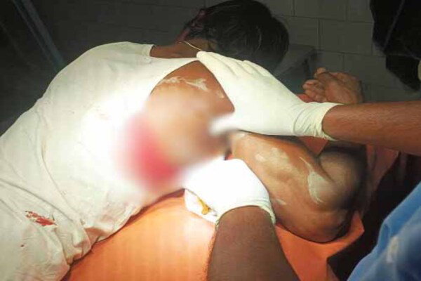 Ranchi News : पिठोरिया में आपसी विवाद में युवक को मारी गोली, रिम्स रेफर