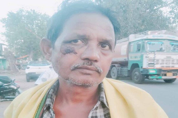 सिमडेगा: कोलेबिरा में पुलिस पर मारपीट का आरोप, पीड़ित ने SP से लगाई न्याय की गुहार