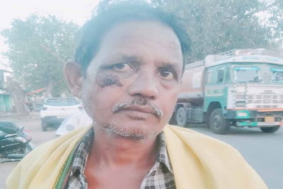 सिमडेगा: कोलेबिरा में पुलिस पर मारपीट का आरोप, पीड़ित ने SP से लगाई न्याय की गुहार