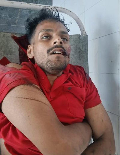 पलामूः जपला-हैदरनगर रेलखंड पर ट्रैक किनारे से घायल अवस्था में मिला युवक, मौत